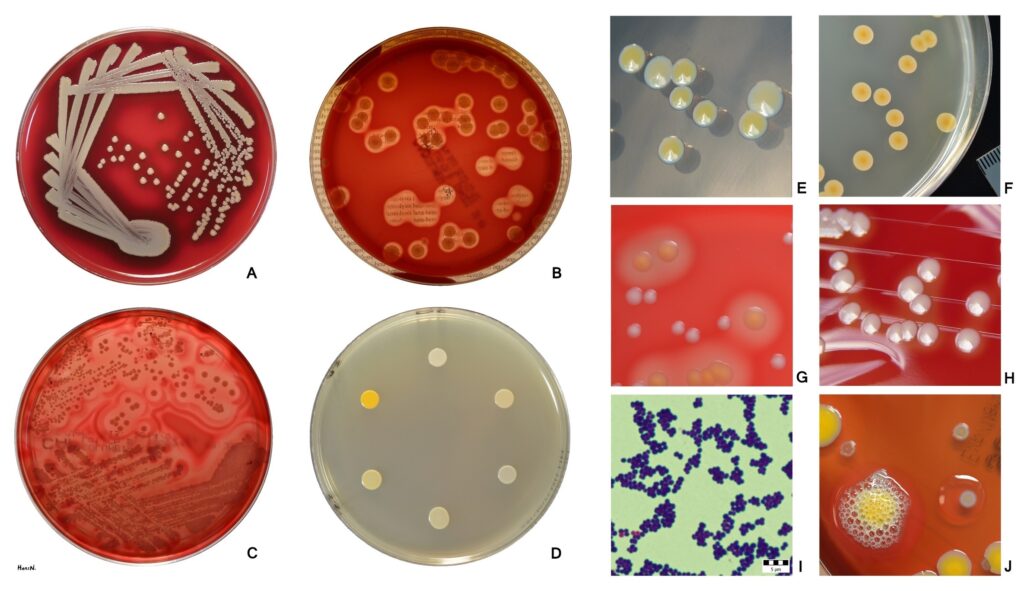 Staphylococcus aureus appearance on agar plate